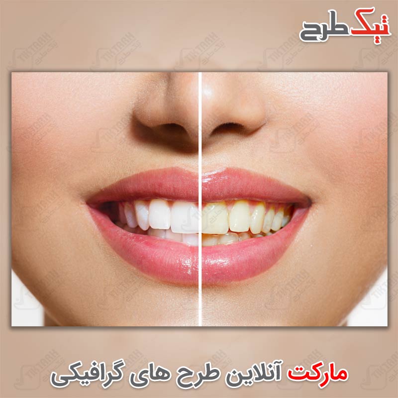 دانلود عکس با کیفیت دندانهای سفید شده