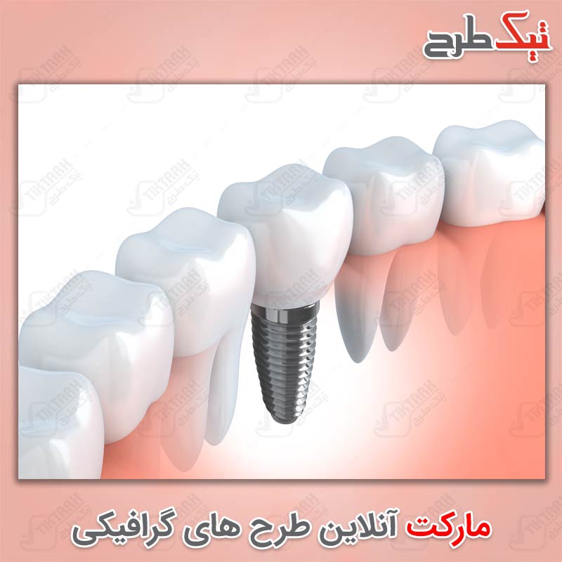 دانلود عکس گرافیکی با کیفیت دندان مصنوعی