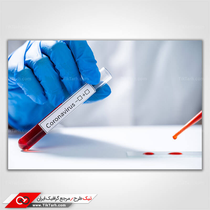 عکس گرافیکی با کیفیت آزمایش ویروس کرونا