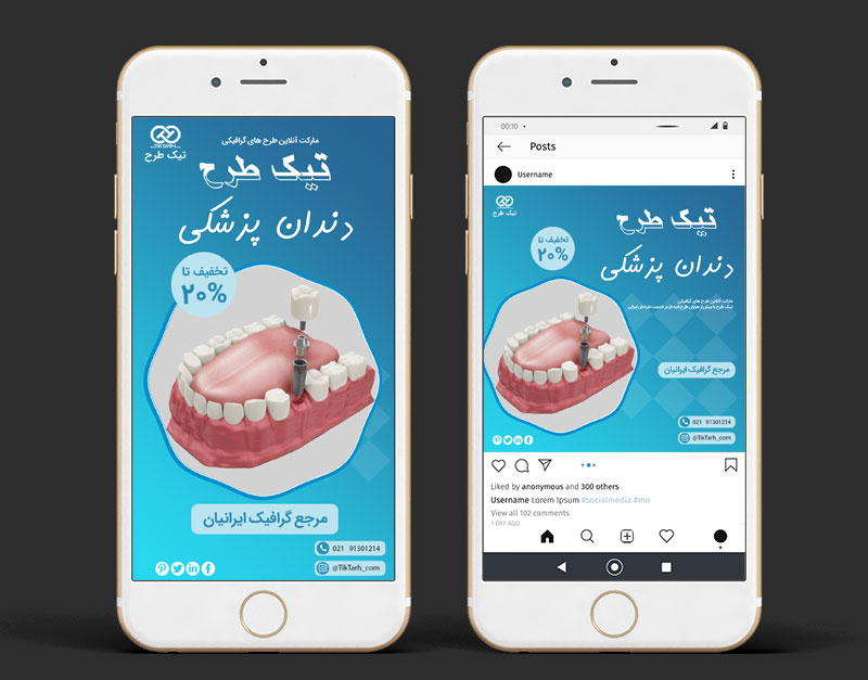 طرح لایه باز قالب اینستاگرامی دندان پزشکی